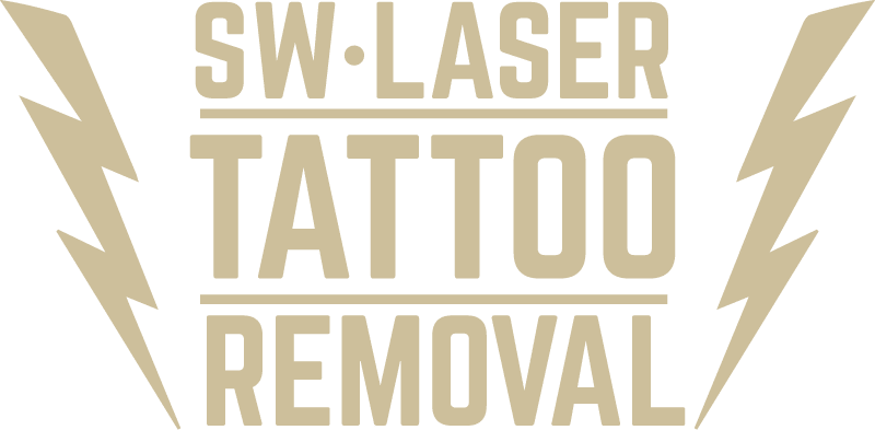 SW Laser Tattoo Removal gold logo